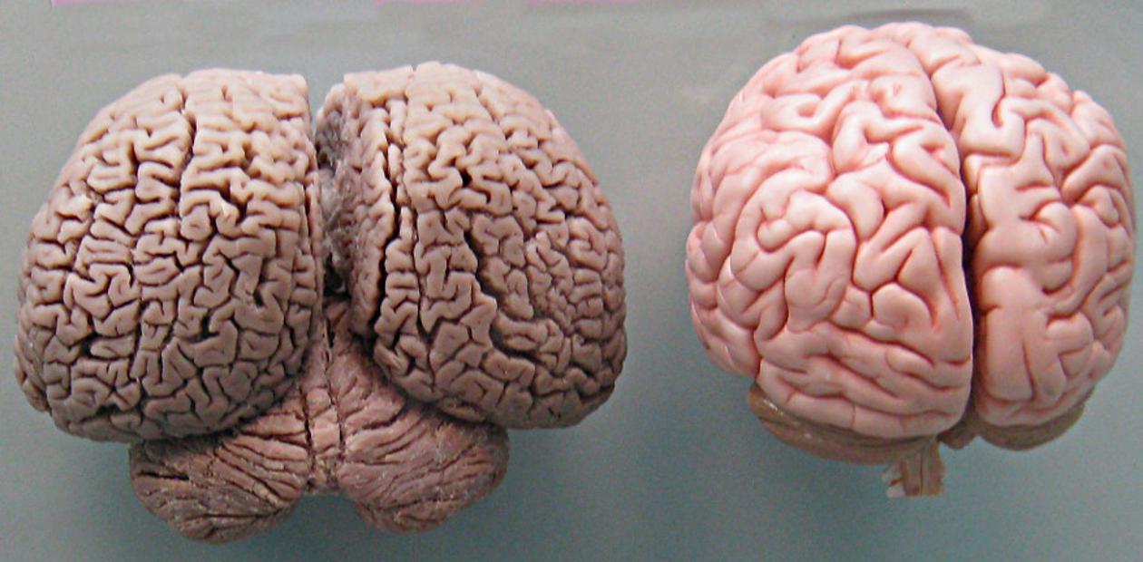Как Выглядит Мозг Фото