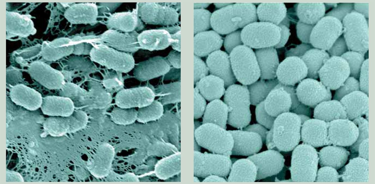 Фото бактерий под микроскопом – Статьи на сайте Четыре глаза