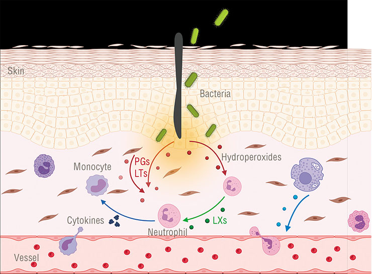 An invasion of any infectious agent usually leads to inflammatory process development. In these conditions, the action of pro-inflammatory oxylipins (prostaglandins, PGs; leukotrienes, LTs) is partly counterbalanced by the action of their anti-inflammatory counterparts (lipoxins, LXs). They inhibit leukocyte activity and prevent inflammation from becoming uncontrolled. Created with BioRender.com