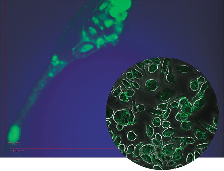 Так выглядят под флуоресцентным микроскопом макрофаг/пенистые клетки, полученные при введении бактериального полисахарида. Зеленые липидные включения, окрашенные специальным красителем, могут занимать более половины клеточной цитоплазмы