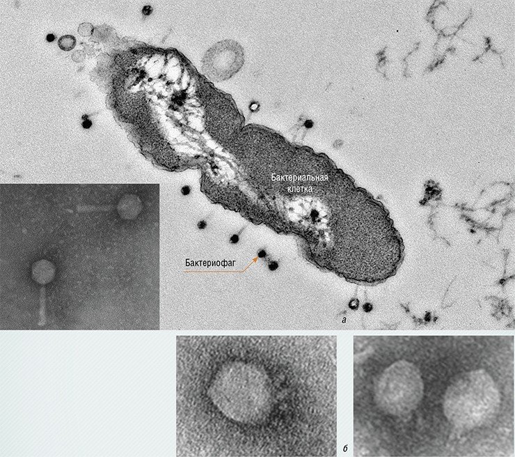 «Хвостатые» бактериофаги, нападающие на бактерию Pseudomonas aeruginosa (синегнойную палочку) (а) и бактериофаги, инфицирующие бактерии Proteus mirabilis (б), вызывающие заболевания мочеполовых органов, в том числе простатит, цистит и пиелонефрит. Электронная микроскопия. Фото Е. И. Рябчикова