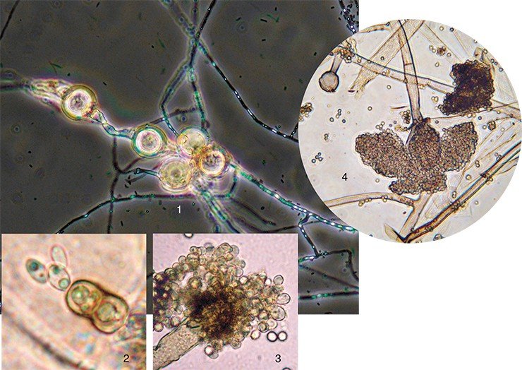 Среди всех живых организмов грибы выделяются разнообразием способов размножения: 1 – хламидоспоры хищного гриба Duddingtonia flagrans; 2 – почкование клеток дрожжей р. Aureobasidium; 3 – конидиеносец с головкой конидий гриба р. Aspergillus; 4 – спорангиеносцы с эндогенными спорангиоспорами гриба р. Rizopus 