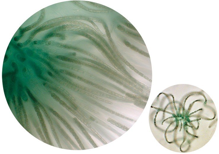 Этот «безопасный» вид цианобактерий – Gloeotrichia echinulata – ранее доминировал в оз. Котокельское, но сейчас уступил свои позиции токсичным представителям родов Anabaena и Microcystis (справа – A. lemmermannii)