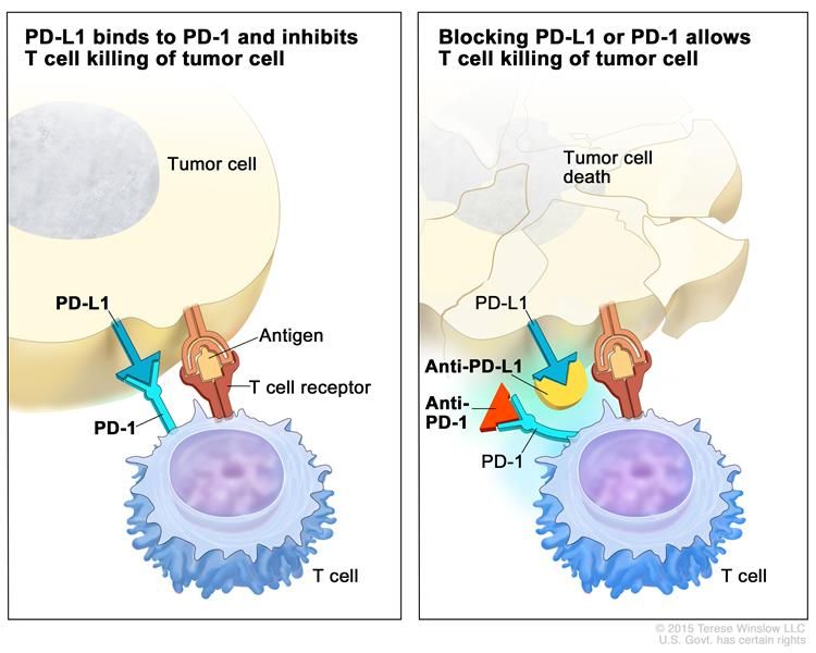 рецептор Т-лимфоцита PD-1 связывается со своим лигандом PD-L1 на клетке опухоли