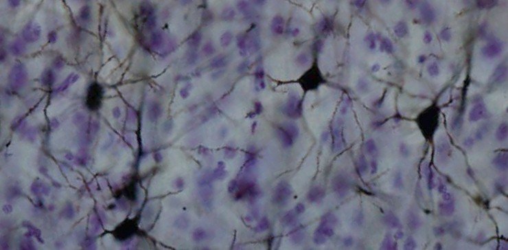 NeuronGolgi. rr.jpg