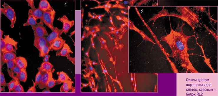 Обработка клеток рака груди человека линий MCF-1(а) и MSC (б) белком RL2 инициирует апоптоз, при этом RL2 связывается с белками клеточного цитоскелета, провоцируя нарушения мембран митохондрий. Флюоресцентная микроскопия