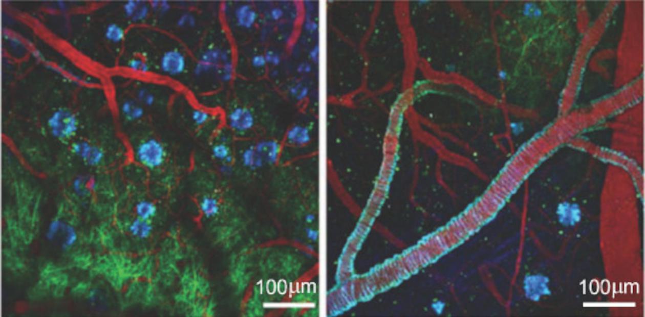 Двухфотонная микроскопия мозга мыши – модели болезни Альцгеймера. Патологический белок-амилоид окрашен синим, нейроны трансгенной мыши, экспрессирующие зеленый флуоресцентный белок, – зеленым, кровеносные сосуды – красным