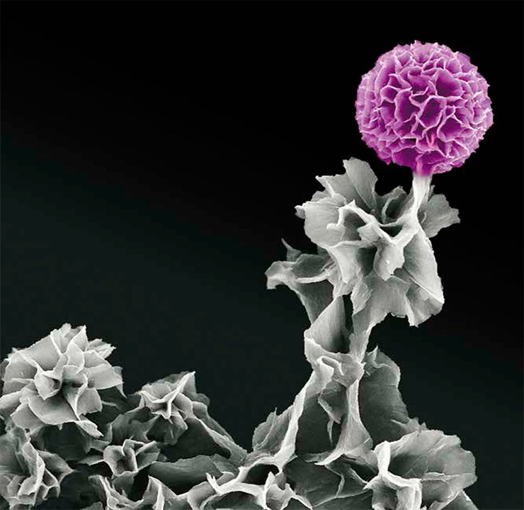 Scanning electron microscopy. Image courtesy of the Materials Research Society (www.mrs.org) Science as Art Competition (spring 2013) and Yue Wang, University of California, Los Angeles, USA