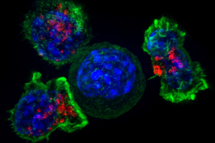Т-лимфоциты окружают раковую клетку. © Alex Ritter, Jennifer Lippincott Schwartz and Gillian Griffiths, National Institutes of Health
