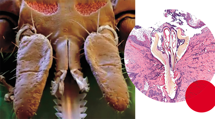 The sophisticated oral apparatus of a sucking ixodid tick (left) works like a pump, making 2–60 acts of suction per minute, which alternate with acts of saliva injection. © CC BY 2.0, photo by Pw95. In the photo right: microscopic image of a tick’s mouth with barbs, which has penetrated into the dermis, i. e., the lower layer of the skin, of the animal host. © CC BY 2.0, photo by LozeauMD