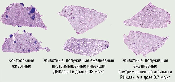 Антиметастатическую активность нуклеаз можно оценить по гистотопограмме долей легких мышей C57Bl/6 с карциномой легких Льюис – модели рака, метастазирующего в легкие. Окрашивание гематоксилином и эозином