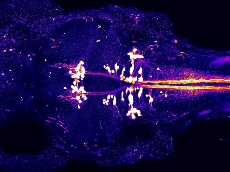 Голова и начальная часть тела неполовозрелой рыбки данио (вид сверху, глаза слева). Нейроны (белые пятна) посылают сигналы в спинной мозг, координируя движения тела. © CC BY-NC 2.0/ Richard Roberts, Ph.D., Washington University School of Medicine, NIDCD