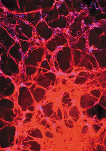 Нейроны, дифференцированные из индуцированных плюрипотентных стволовых клеток. Флуоресцентная микроскопия. Фото М. Лагарьковой 