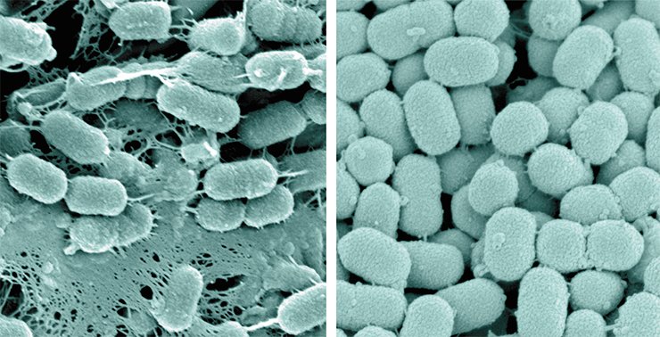An electron microscopy image of a bacterium belonging to the genus Prevotella, one of the microorganisms determining the human enterotype. One of the strains of these bacteria (left) forms peculiar “networks” which are likely to assist their attaching to intestinal walls. Another strain (right) does not form such structures, which in no way prevents it from flourishing in our intestines