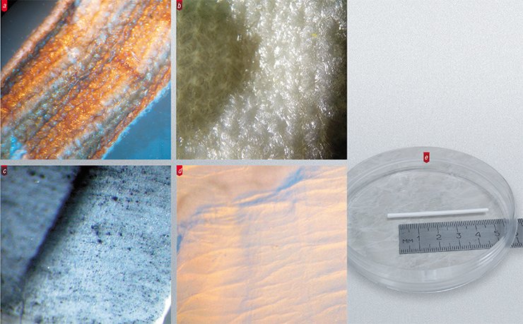 The inner surface of synthetic vascular prostheses used in current surgical practice is very rough, hairy, and unable to maintain the development of a normal cell layer unlike the prostheses produced by electrospinning: (a) an Intergard knitted prosthesis; (b) a Vascutek knitted prosthesis of lavsan; (c) a GoreTex teflon prosthesis; (d) an electrospun prosthesis of nylon; and (e) a whole electrospun vascular prosthesis of	polycaprolactone. Light microscopy. Photo by the courtesy of A. Lebedeva