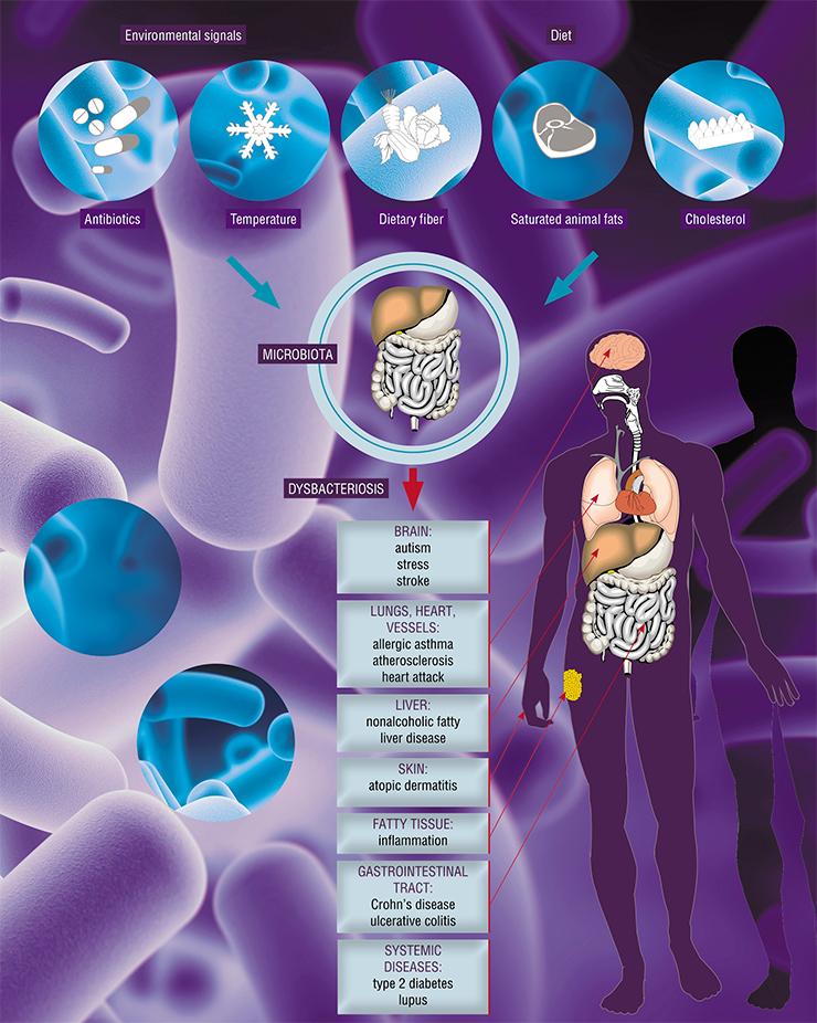 Imbalance of intestinal microbiota is connected to disorders not only of the digestive tract, but also of other organs, too, as well as systemic and oncological disorders and various inflammatory processes. Based on: (Schroeder & Bäckhed, 2016)