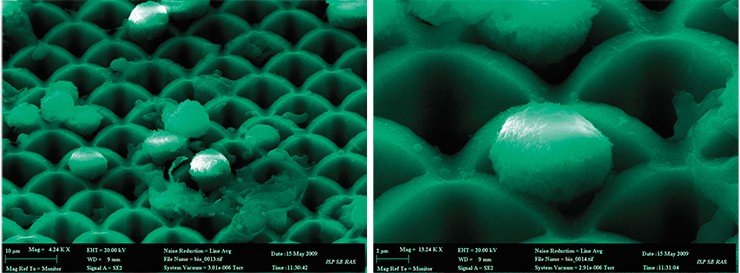 Онкотрансформированные клетки HeLa на поверхности микроканальной матрицы с периодом ячейки 10×10 мкм. Сканирующая электронная микросокопия. ЦКП «Наноструктуры» при ИФП СО РАН им. В. А. Ржанова