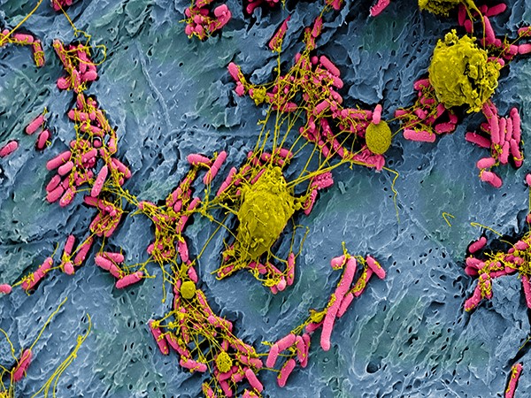 Мочевой пузырь лабораторной мыши, инфицированный бактерией Escherichia coli (розовым цветом) – частая причина инфекции мочевых путей. Лейкоциты (желтым цветом) используют волокнистые внеклеточные ловушки, чтобы обездвижить и убить бактерии. © CC BY-NC 2.0/ NIH Image Gallery