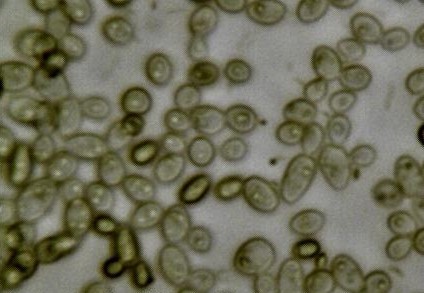 Чайный гриб и образец культуры чайного гриба под микроскопом. © CC BY-SA 4.0/ Lukas Chin и John Alan Elson