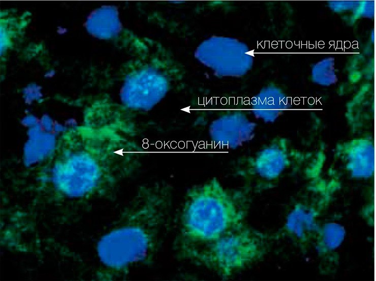 Самый распространенный дефект ДНК На срезе печени крысы благодаря специальным методам отчетливо виден 8-оксогуанин (зеленого цвета) не только в ядрах, но и в цитоплазме клеток. Фотография Е. Кемелевой (ИХБФМ СО РАН) 
