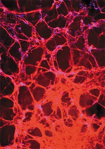 Нейроны, дифференцирванные из ИПСК. Окраска антителами на бета-III тубулин. Флуоресцентная микроскопия. Фото автора