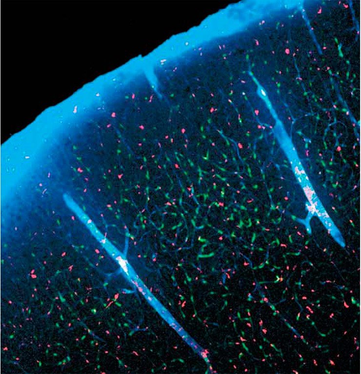 Во время сна объем клеток головного мозга у лабораторных мышей сокращался более чем наполовину, соответственно увеличивались каналы (голубой цвет) между клетками, заполненные спинномозговой жидкостью. Так работает «мусоропоровод» по выведению из мозга токсических «отходов». Двухлучевая конфокальная микроскопия. Credit: Jeff Iliff and Maiken Nedergaard