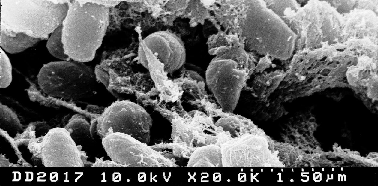 Бактерии Yersinia pestis (возбудитель бубонной чумы) в кишечнике блохи. Сканирующая электронная микроскопия. Credit: NIAID