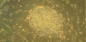 Как из стволовых клеток получить сперматозоиды?