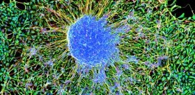 Трансплантация нейронов восстановит утраченные функции мозга