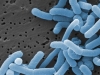Лактобактерии пробиотиков могут попадать в кровь и вызывать ее заражение