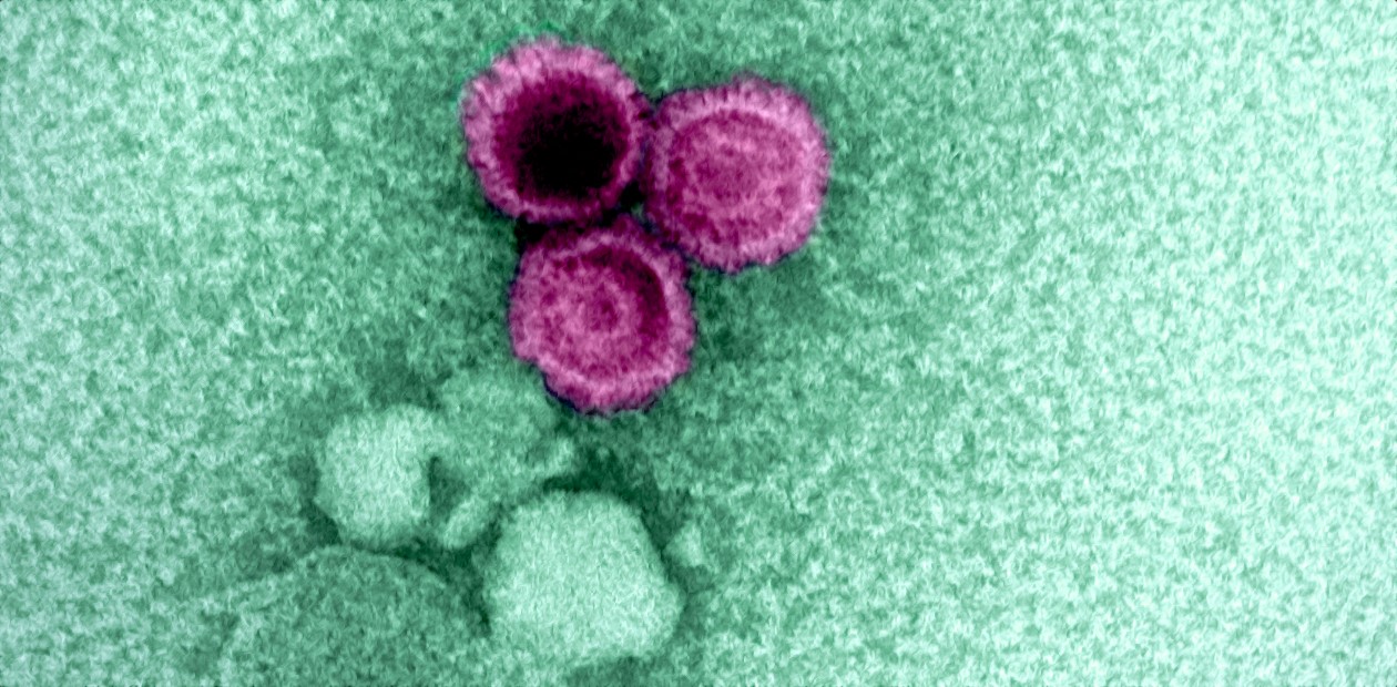 «Спящий» вирус Эпштейна-Барр – причина тяжелого осложнения COVID-19 у детей