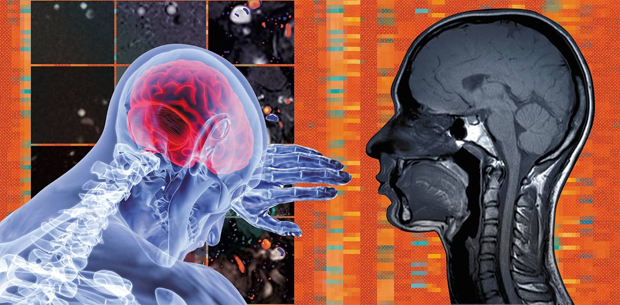 В водовороте жизни#МРТ-визуализация мозга и жидких сред организма