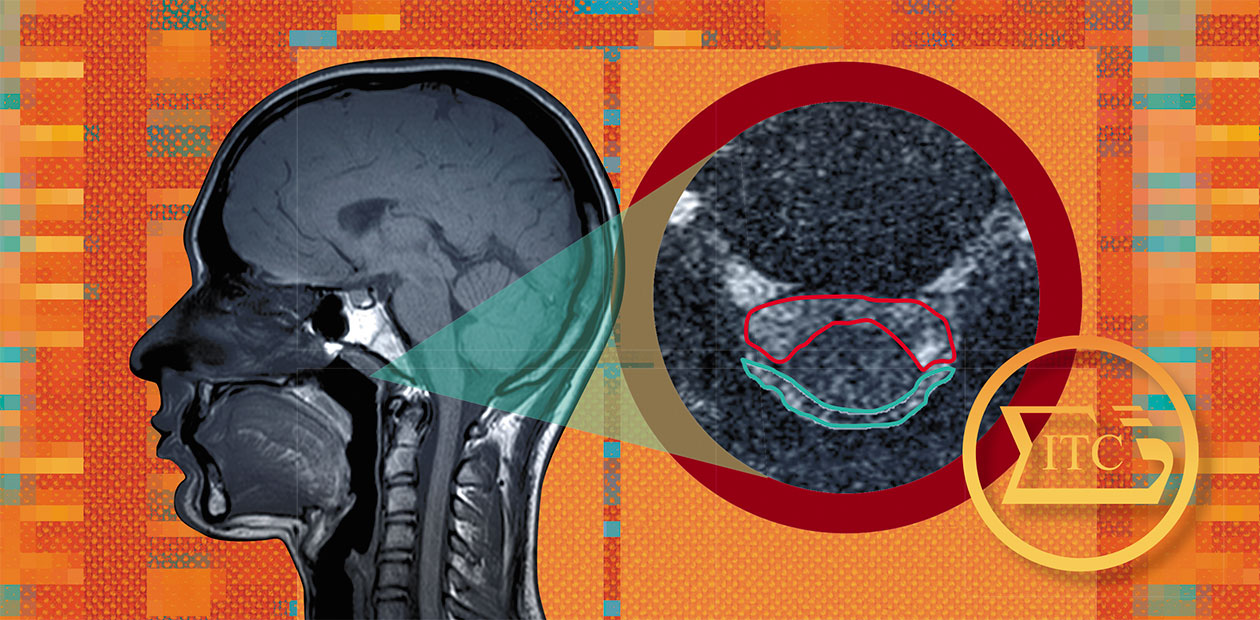 В водовороте жизни # МРТ-визуализация мозга и жидких сред организма