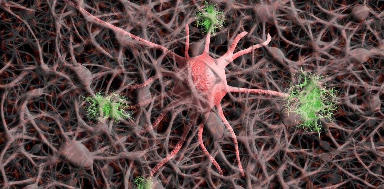 Рак против болезни Альцгеймера?