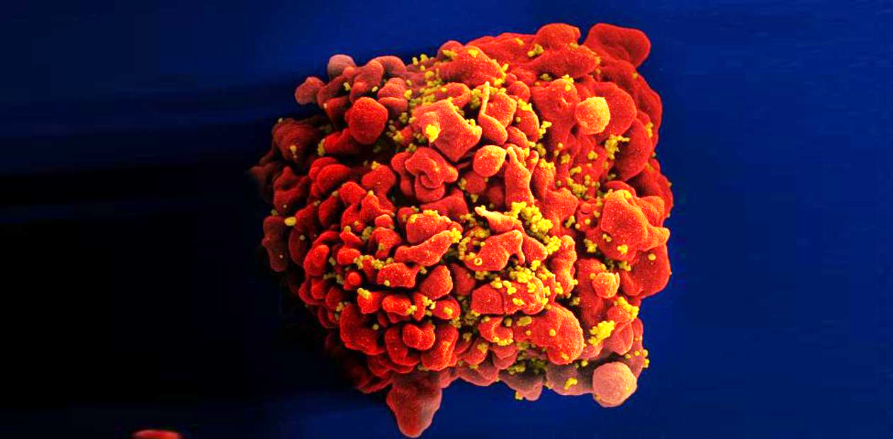Ждали долго: второй в мире больной с ВИЧ-инфекцией излечен пересадкой клеток костного мозга