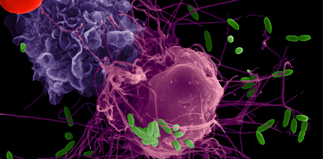 Мишенью антибиотиков служат не только бактерии, но и иммунные клетки организма
