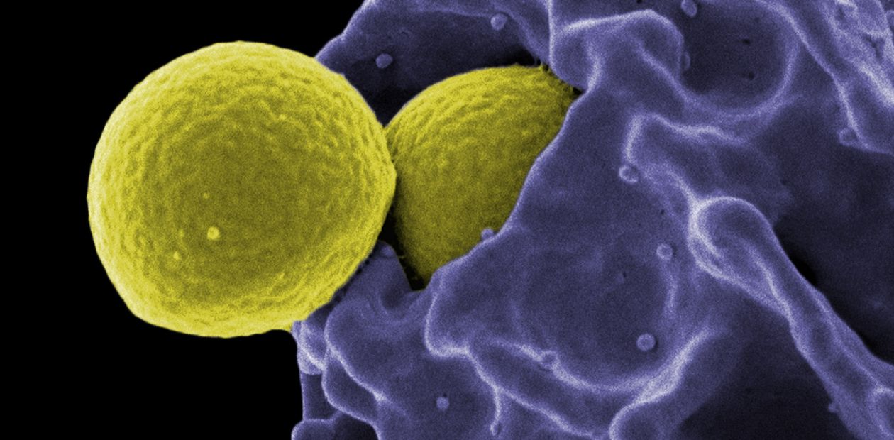 Бактерии и дрожжевые грибки умеют защищаться от  атак свободных радикалов