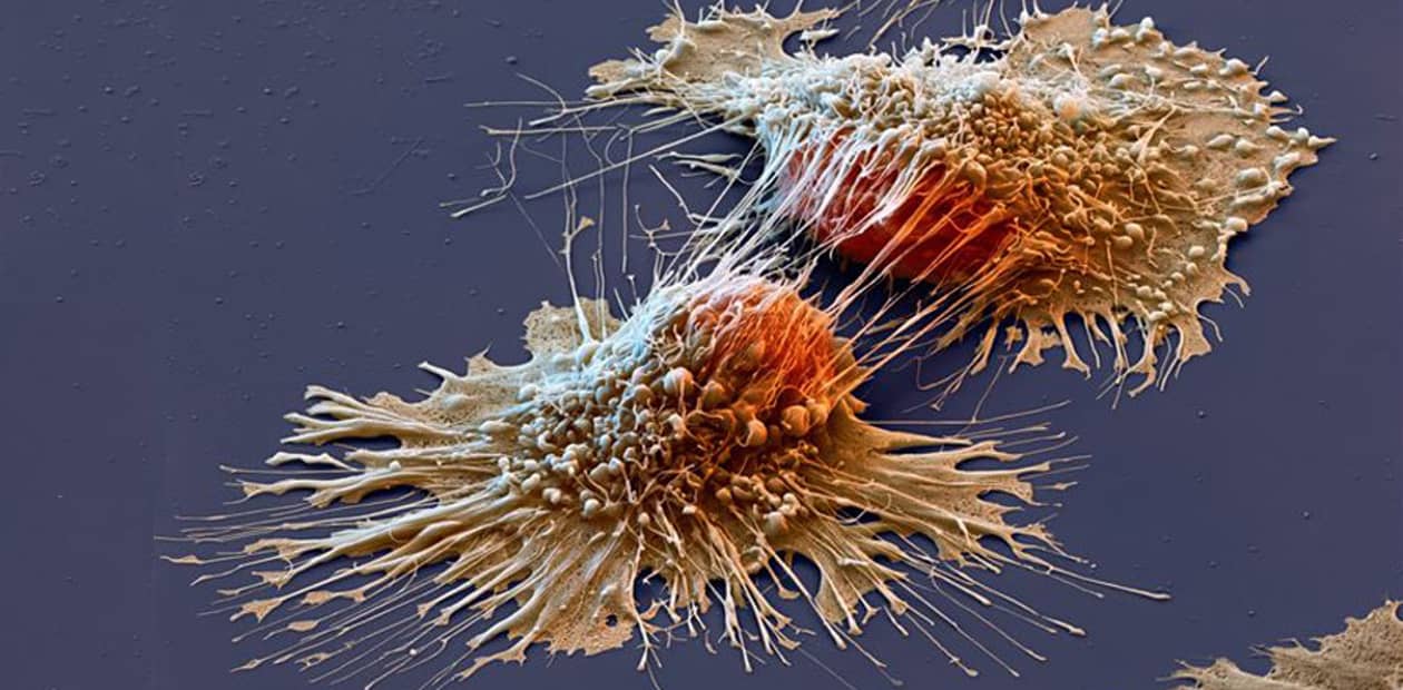 Знание молекулярных механизмов «чудесных выздоровлений» от рака поможет бороться с ним