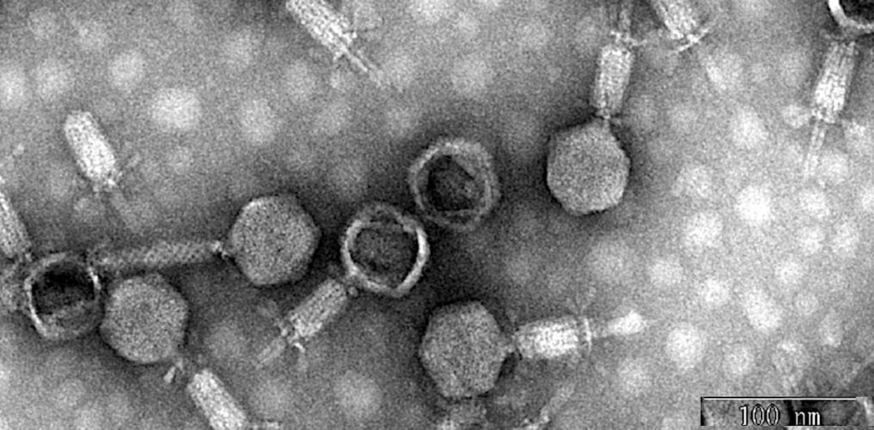 Бактериофаг IME285, специфично поражающий бактерию Acinetobacter baumannii – одного из ключевых возбудителей внутрибольничных инфекций (сепсис, пневмонию, ревмокардит и др.) на фоне ослабленного иммунитета, после операций или при использовании инвазивных устройств. Электронная микроскопия. По: (Wang et al., 2020)