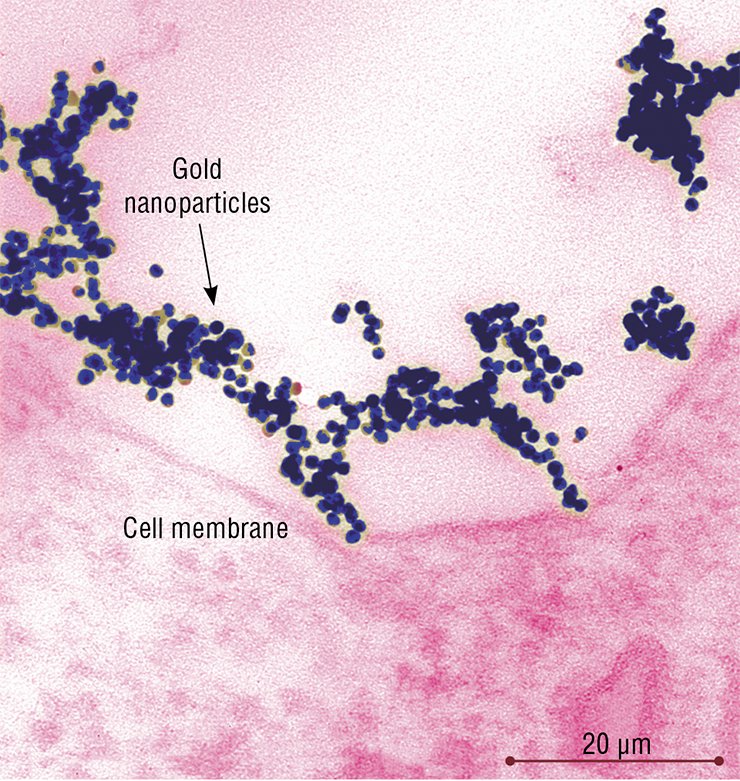 At 10 º C, the temperature which arrests the uptake of substances by the cell, gold nanoparticles rapidly form loose associations the size of up to 2.5 µm. Fancy figures of thousands of nanoparticles contact the cell plasma membrane
