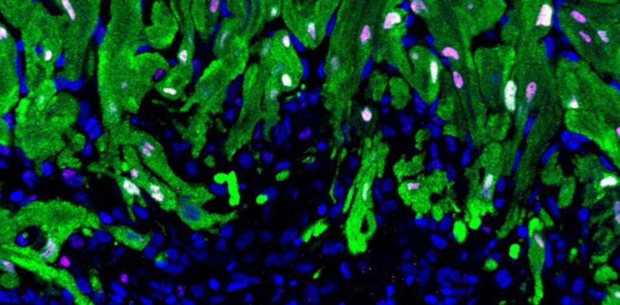 Клетки сердечной мышцы рыбки данио рерио (зеленого цвета), расположенные на границе раны, делятся, образуя новые, которые медленно замещают рубцовую ткань (синего цвета). © CC BY 4.0/ Fabian Kruse