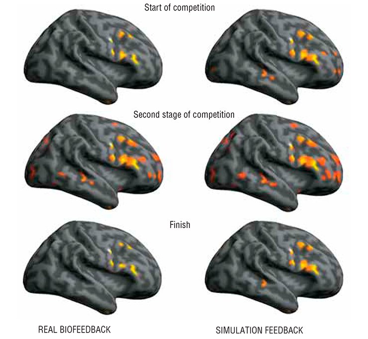 Vira!: In the modes of real and “false” (simulation) biofeedbacks aimed at the cognitive control of the pulse rate, the brain zone activation follows similar patterns although displays some minor differences. In particular, the brain activation zones are considerably enriched in the simulation biofeedback mode as compared with the real feedback mode, namely new neuronal ensembles appear in the cerebellum, fusiform gyrus, pons, stem structures, and some other brain areas. The maximal increase in the activation volume is observed during the second stage of game biofeedback, that is 8 to 12 minutes after involvement into a real or a false game plot. Then, as the game progresses these values decrease considerably. Although both biofeedback modes display similar qualitative patterns, their quantitative details differ considerably