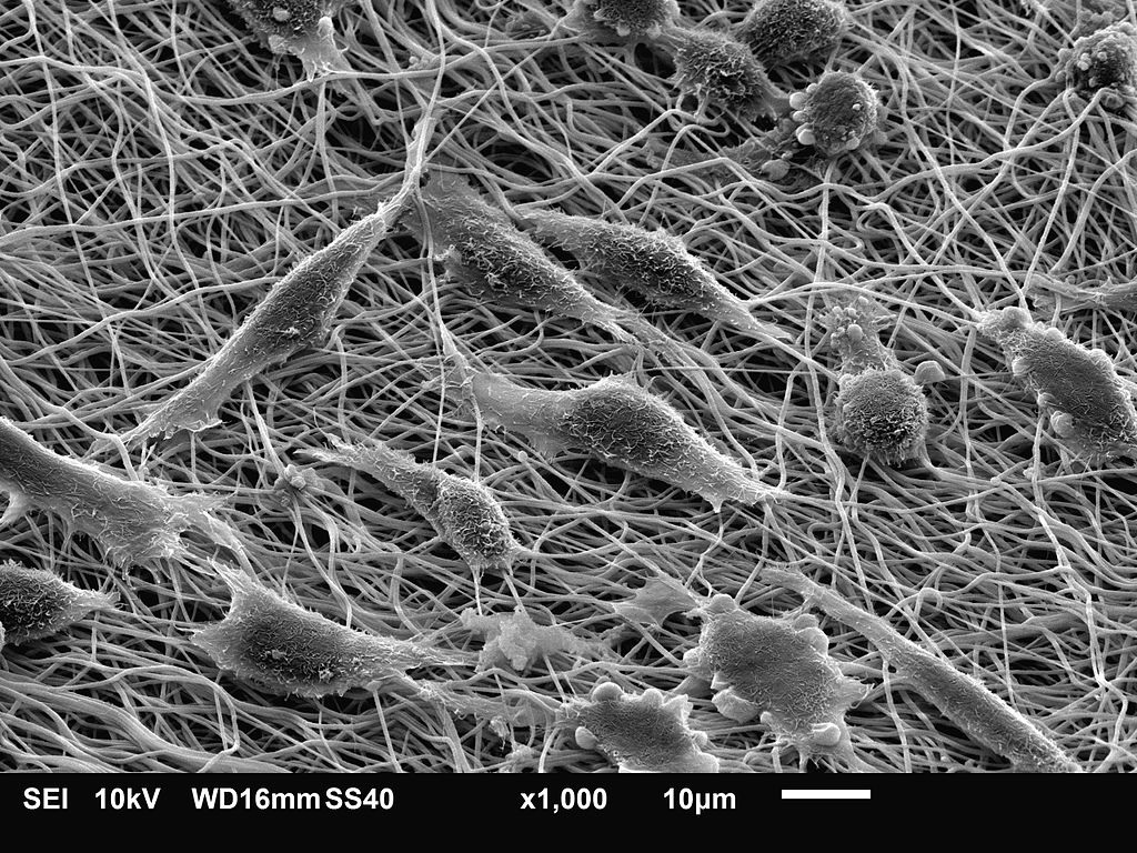 Фибробласты мыши в культуре, сканирующая электронная микроскопия
