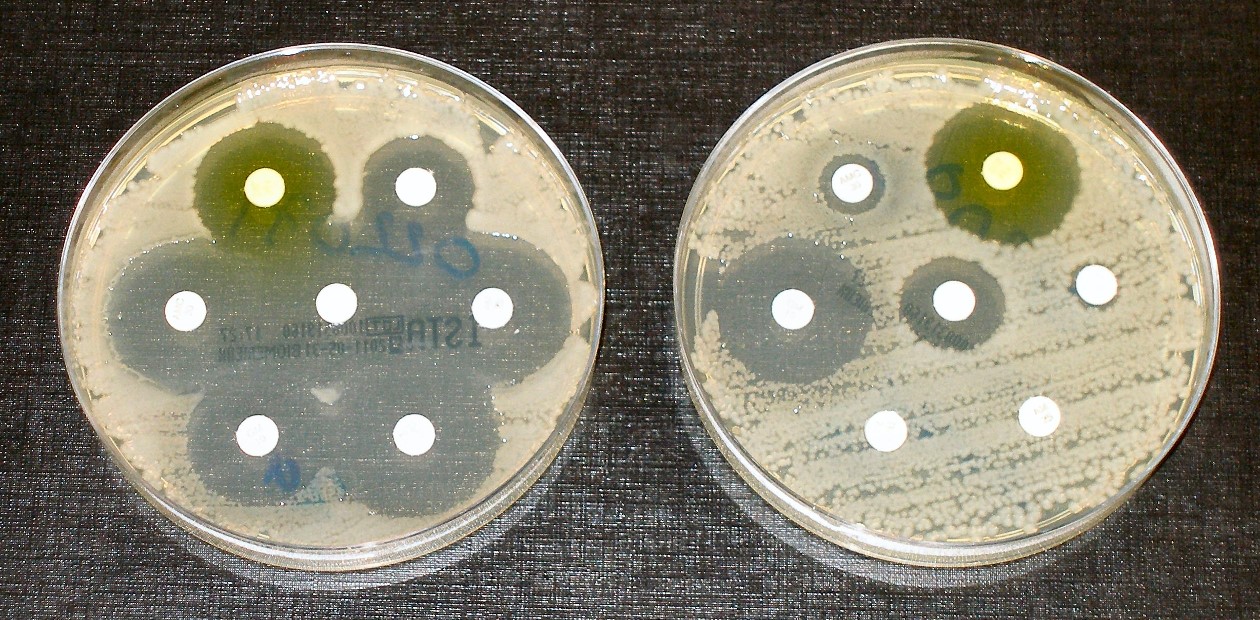 Тест на устойчивость бактерий к антибиотикам, которые нанесены на белые бумажные диски. Бактерии в правой чашке Петри устойчивы к большинству антибиотиков. Credit: Dr Graham Beards