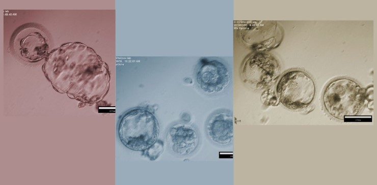 На этих фотографиях представлены бластоцисты – результат дробления яйцеклетки на ранней стадии развития зародыша млекопитающего. Для получения яйцеклеток использовалась методика переноса ядра соматических клеток. Credit: Shoukhrat Mitalipov, Oregon National Primate Research Center, Oregon Health & Science University