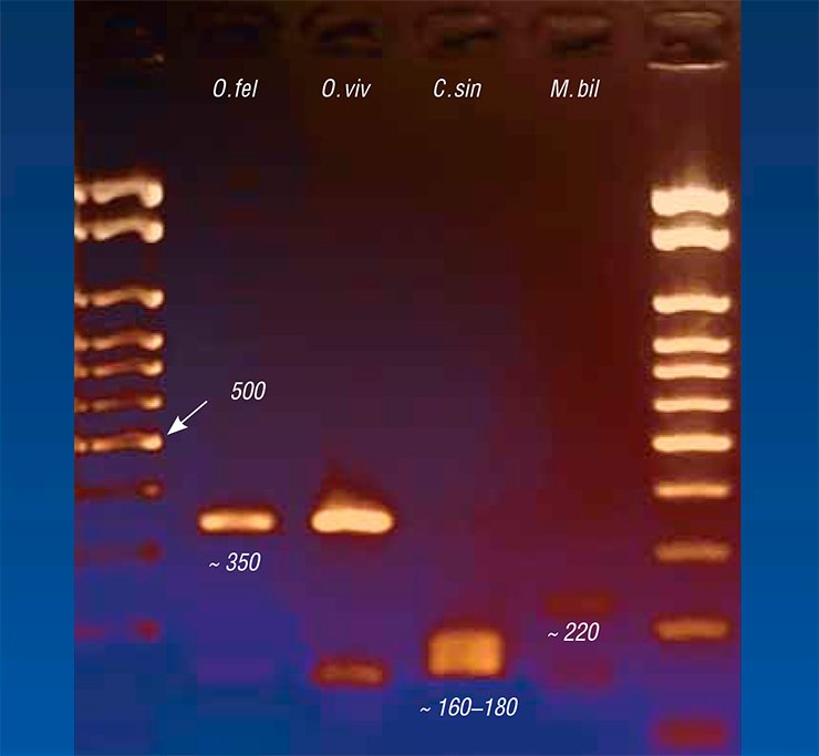 Today, the most precise method in diagnosing trematodiases is PCR-based approach. The test kits for differential PCR * diagnostics of opisthorchiasis agents based on several genetic markers have been developed at the Institute of Cytology and Genetics, Siberian Branch, Russian Academy of Sciences. Left, electrophoretic pattern (agarose gel) of the PCR products amplified from the DNA of four epidemiologically significant liver fluke species, namely, O. felineus, O. viverrini, C. sinensis, and M. bilis (molecular weights of fragments are shown). *PCR, polymerase chain reaction, is a method for synthesizing a large number of copies of an initial DNA fragment
