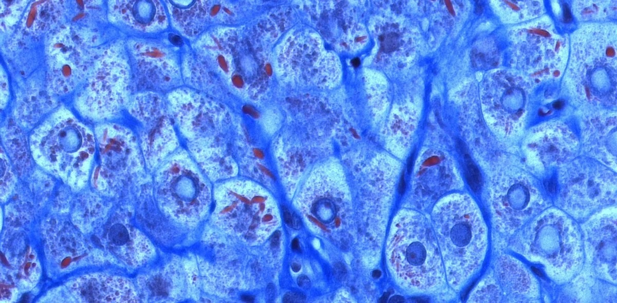 Клетки печени – гепатоциты. Световая микроскопия