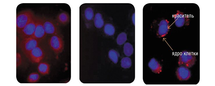 Для определения активности молекулярного насоса Р-гликопротеина в клетках используют флуоресцентный краситель родамин 123, поведение которого моделирует поведение лекарственных препаратов. Флуоресцентная микроскопия. Ядра клеток окрашены синим, родамин 123 светится красным