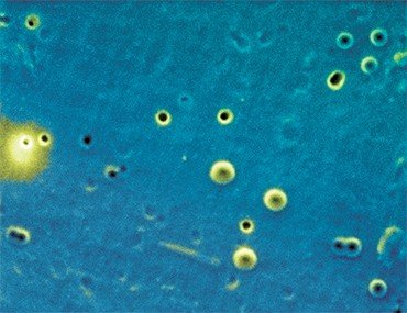Байкальский термофильный факультативный анаэроб рода Paracoccus, выделенный из донных осадков оз. Байкал, образовывал на плотных средах мелкие колонии размером 1–2 мм, состоящие из парных или одиночных клеток диаметром 0,5 мкм. Его способность утилизировать пептон (частично гидролизованный белок) и дрожжевой экстракт, а также расти на минеральной среде в присутствии H₂ и CO₂ доказывает, что он также обладает микотрофным метаболизмом, как и его известные почвенные «родственники». Сканирующая электронная микроскопия. ЦКП «Ультрамикроанализ» (Иркутск)