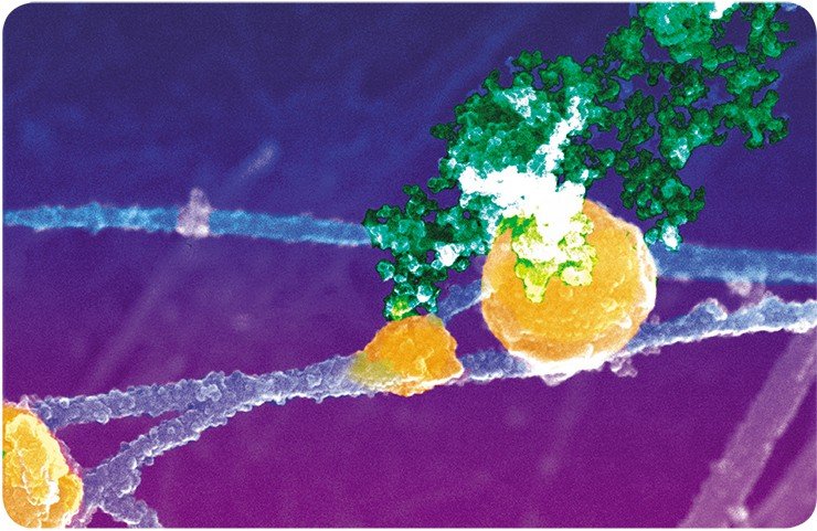 Контакт хроматина (окрашен зеленым) с актинсодержащими филаментами и тельцем Кахала